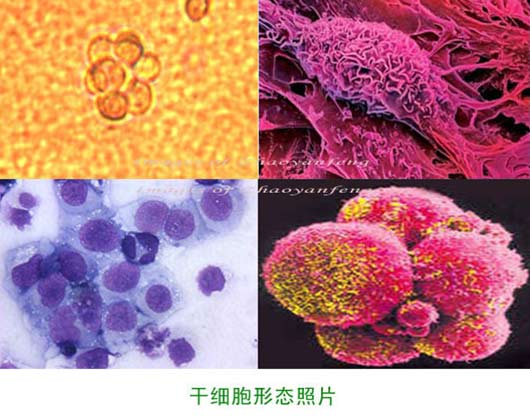 干細胞技術(shù)